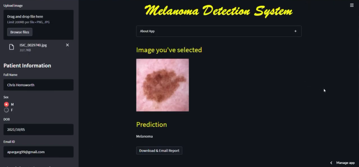 Melanoma Detection System